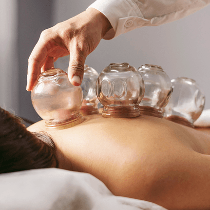 Cupping Therapy