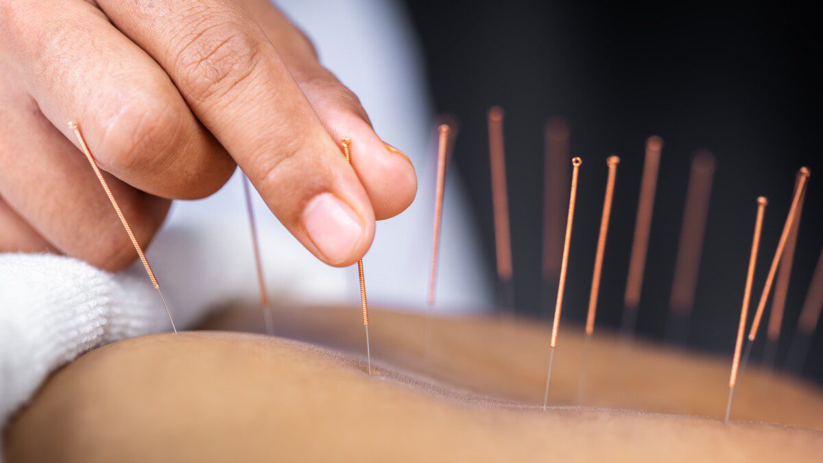 Clinical Acupuncture Treatment